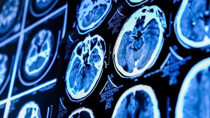 CT Scan